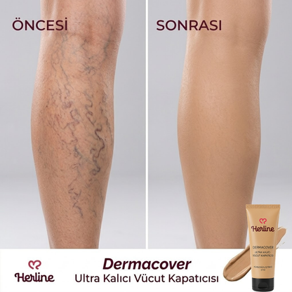 Herline DermaCover Ultra (Kalıcı Vücut Kapatıcısı)