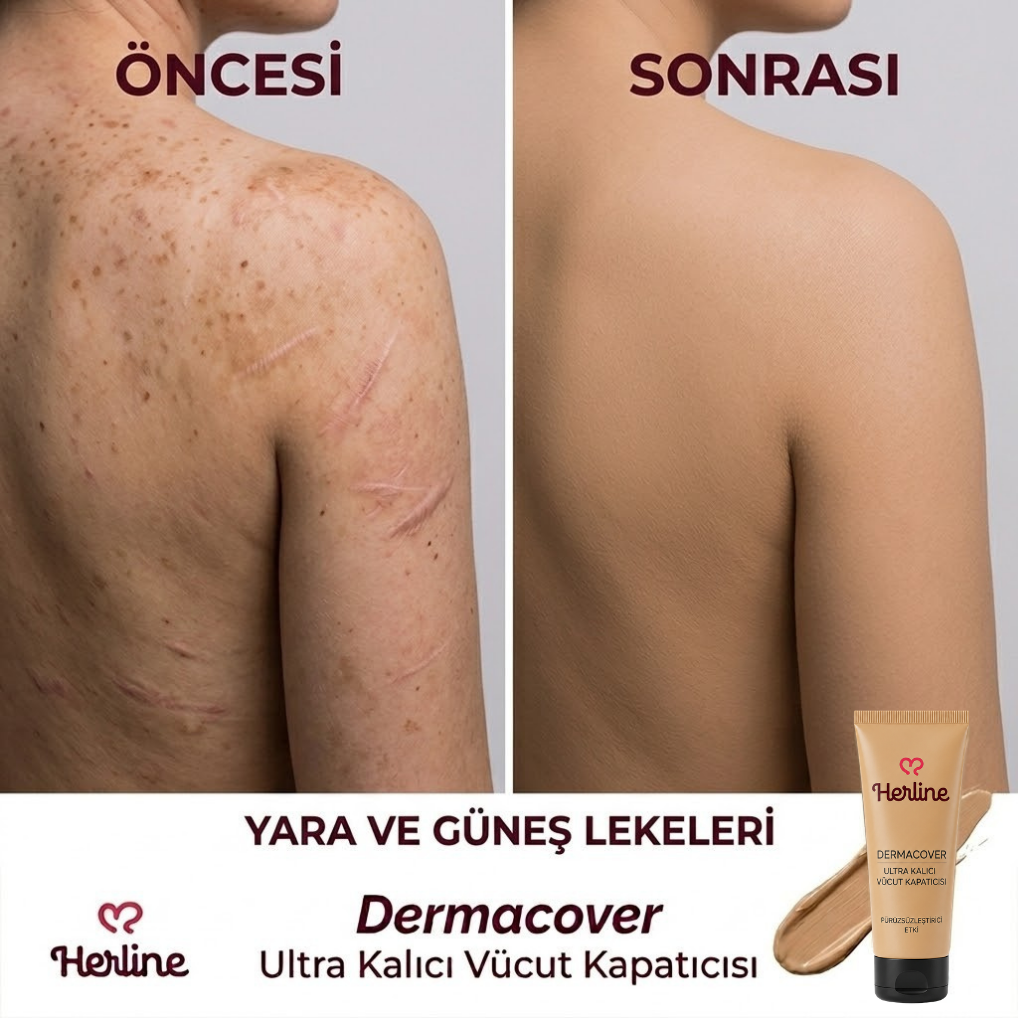 Herline DermaCover Ultra (Kalıcı Vücut Kapatıcısı)