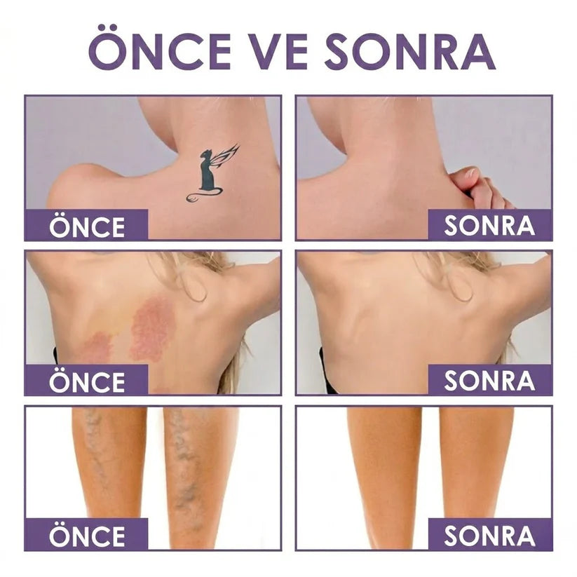 Herline DermaCover Ultra (Kalıcı Vücut Kapatıcısı & Pürüzsüzleştirici Efekt)