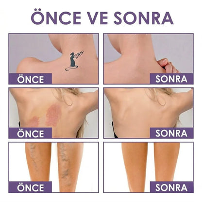 Herline DermaCover Ultra (Kalıcı Vücut Kapatıcısı & Pürüzsüzleştirici Efekt)