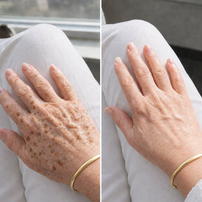 Herline DermaCover Ultra (Kalıcı Vücut Kapatıcısı & Pürüzsüzleştirici Efekt)