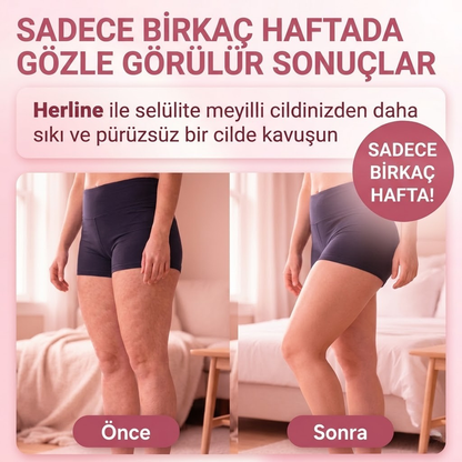 Herline 4'ü 1 Arada Masaj Aleti (Selülit, Lipödem, Lenfödem)
