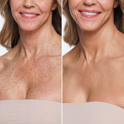Herline DermaCover Ultra (Kalıcı Vücut Kapatıcısı)