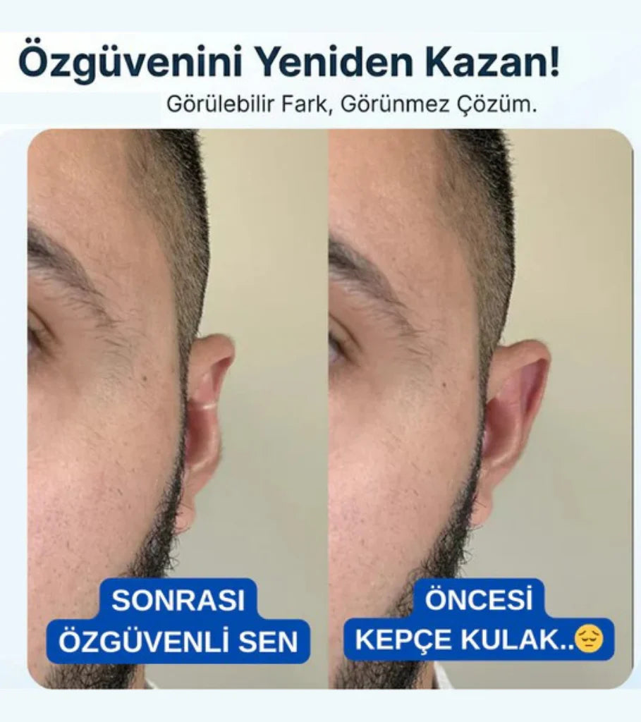 Kepçe Kulak Klipsi