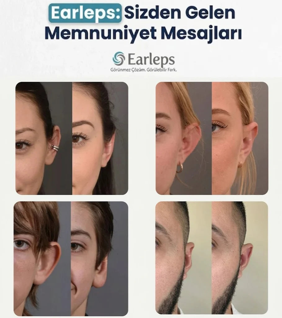 Kepçe Kulak Klipsi