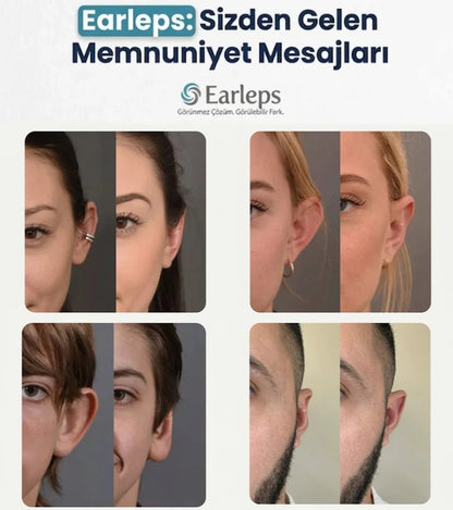 Kepçe Kulak Klipsi