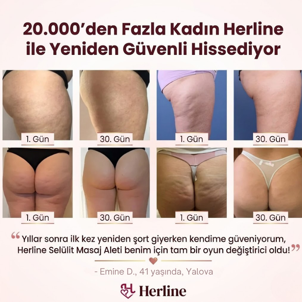 Herline Selülit Karşıtı Masaj Aleti( 7-Etkili Derin Dönüşüm Mekanizmalı)