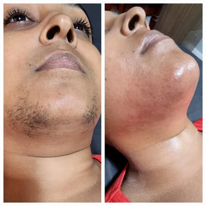 Herline SmoothCycle™ Daha Geç Uzayan Tüyler İçin Bakım Yağı