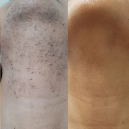 Herline SmoothCycle™ Daha Geç Uzayan Tüyler İçin Bakım Yağı