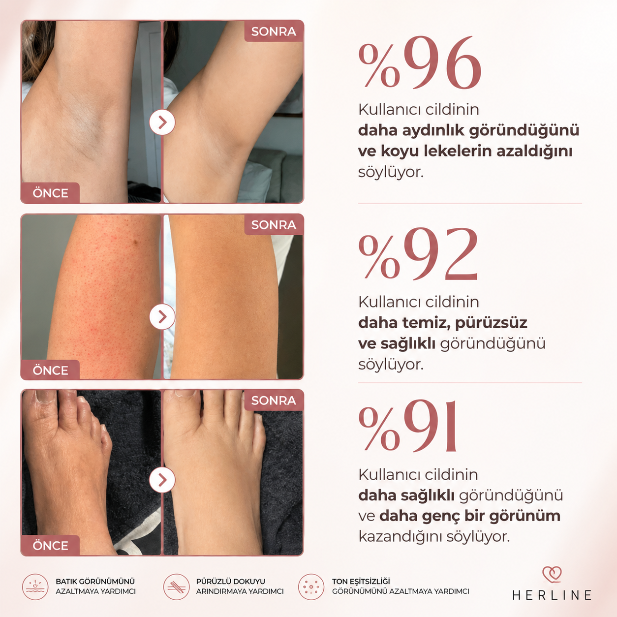 Herline BodyClear™ Kojik Asit + Zerdeçal Vücut Peeling Spreyi